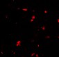 GRK6 Antibody